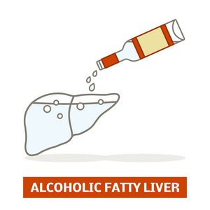 酒精性脂肪肝的概念。一个肝脏的剪影是充满了伏特加
