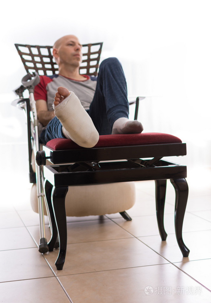 断了的脚踝和小腿石膏的年轻人