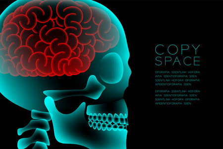 颅内 X 线与显微镜下疾病细胞的脑概念设计, 侧面视图插图孤立发光的黑暗背景, 与复制空间