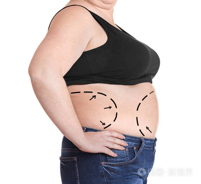 女人明显肥胖问题