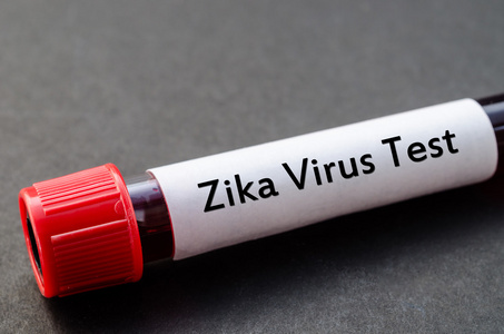 Zika 病毒测试概念