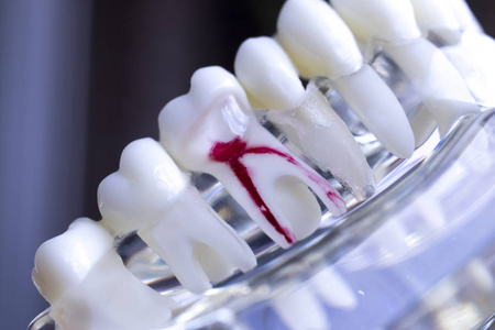 牙医牙科教学模式显示病人和学生的每一颗牙和口香糖