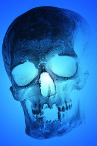 人类的头颅骨的 x 光照片