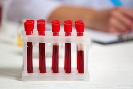 血液样本测试管照片
