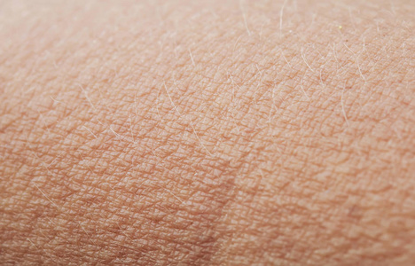 变胖之后皮肤起鸡皮(为什么皮肤会突然变成鸡皮)