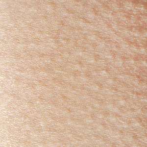 鸡皮人的皮肤被寒冷和惊吓特写小的起鸡皮疙瘩照片