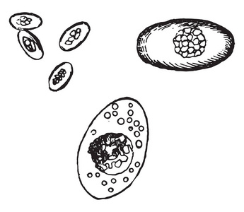 球虫种类 oviforme 从人肝, 复古刻插图