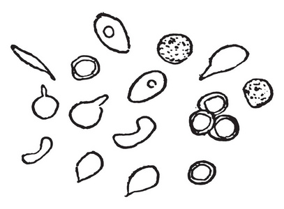 Poikilocytes, 复古雕刻