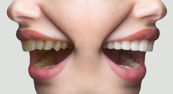 牙科白色微笑概念之前, 和之后，牙齿美白。滑稽面孔 牙科医生 牙医和病人的广告的女人的微笑。牙科诊所，洁白的牙齿。刷你的牙齿