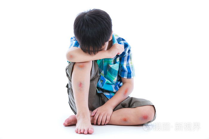 小男孩捂着脸. 根据有伤口的尸体c