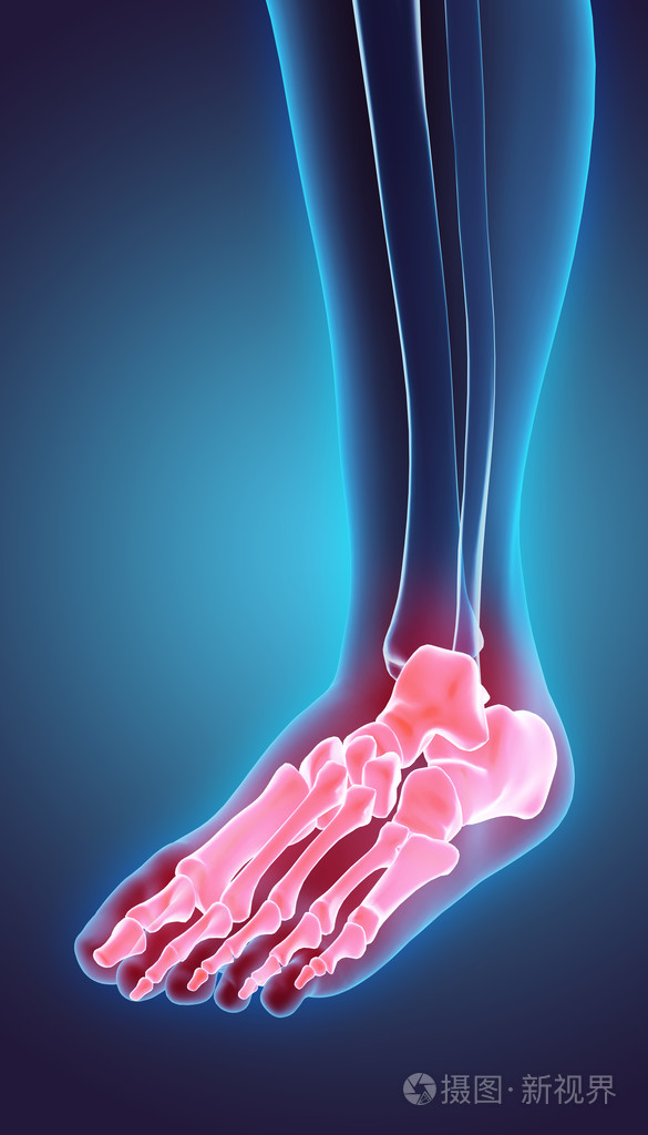 三维图脚骨架,医学概念