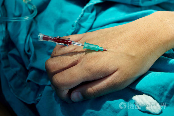 手术室 iv 通道内有血针