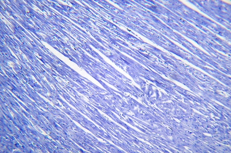 光纤显微镜显微摄影.心肌切片照片