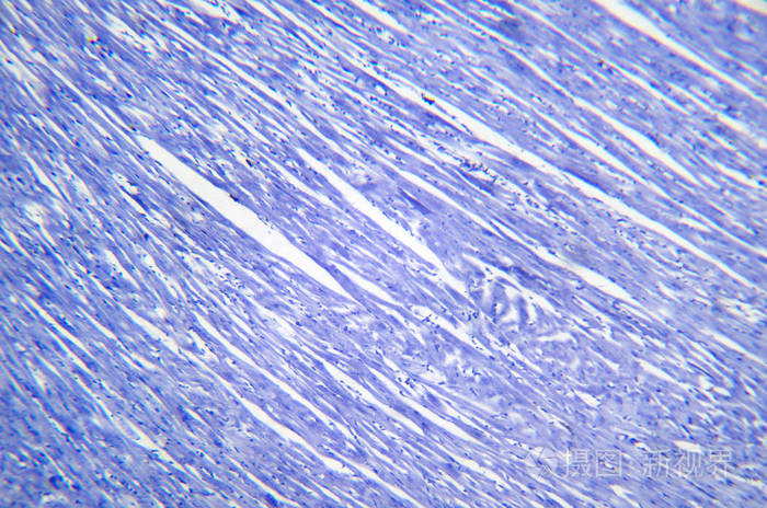 心肌纵切面图片