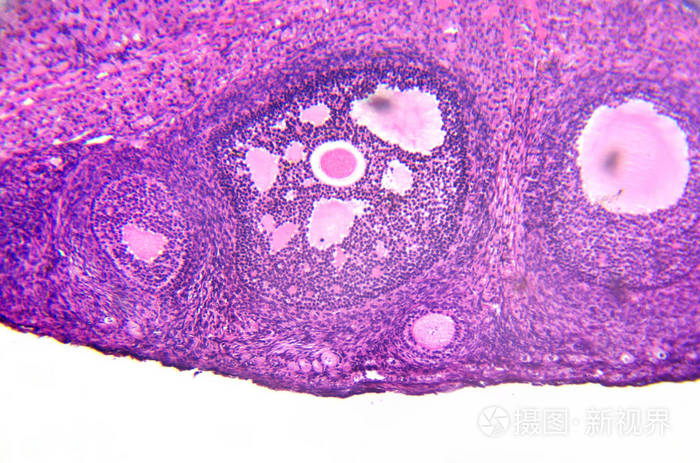 卵巢皮质图片