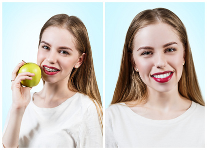 上牙吃苹果的支架的年轻女人