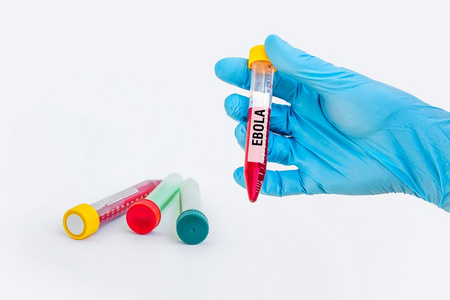 试管与埃博拉病毒测试的血液样本