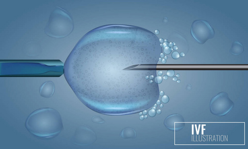体外受精注射。人工授精。科学医学插图载体