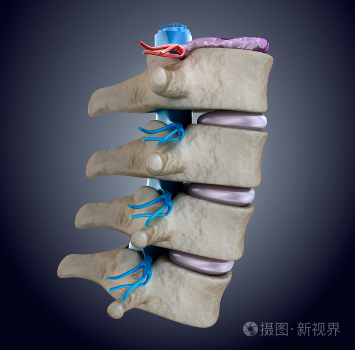 脊髓的椎间盘膨出的压力下