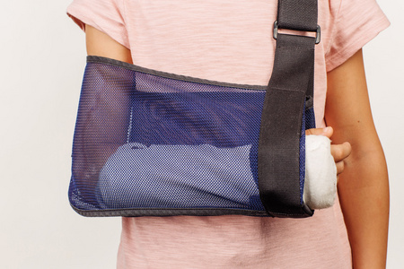 包扎手臂照片女孩的手臂骨折,在一条绷带.这张照片的概念是结合照片