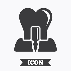 创意种植牙图片