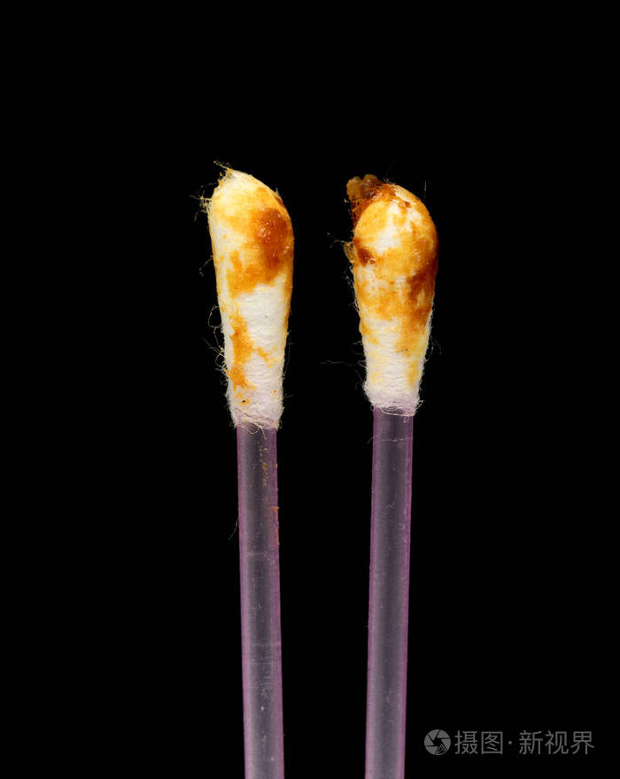 棉签上的耳蜡耵聍