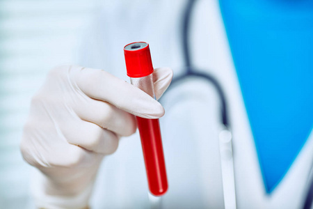 不育真菌,真菌和疾病的医学检验照片