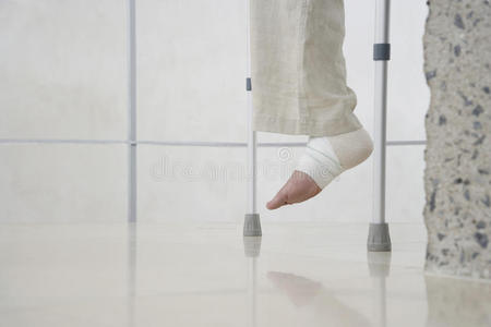 用绷带包扎的人的腿照片