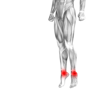 概念脚踝人体解剖学与红色热点炎症或关节关节疼痛的腿保健治疗或运动肌肉的概念。3d. 图示人关节炎或骨质疏松症