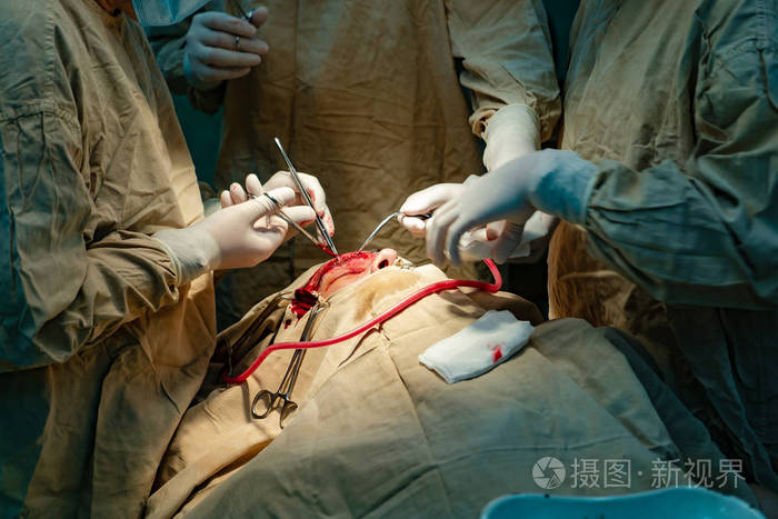 外科医生在医院的医疗器械的帮助下, 在一个男人的脸上进行手术.特写