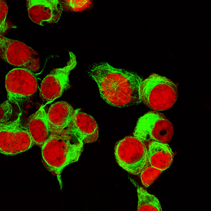真正的荧光微观角度的神经母细胞瘤细胞