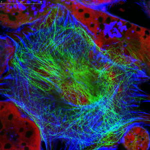 真正的荧光小鼠神经母细胞瘤细胞系的微观角度
