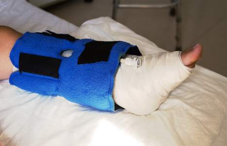 旅行者在绷带的伤腿儿童接触弹性绷带,摔断腿踝关节用拐杖打石膏把腿