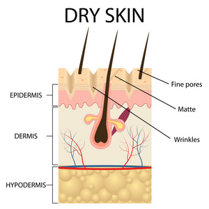 干燥的皮肤层的插图