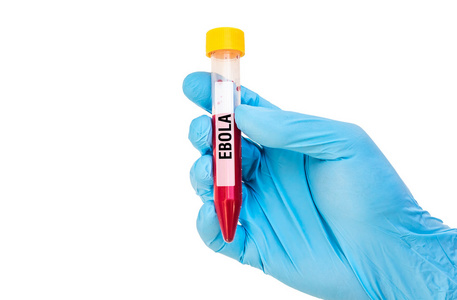 试管与埃博拉病毒的血液样本