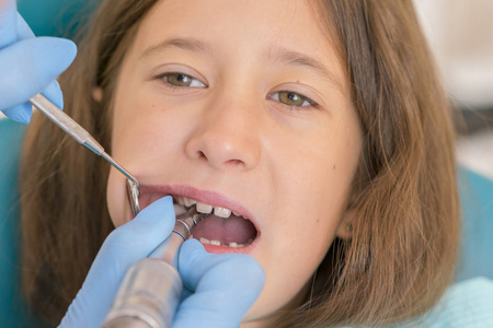 在牙科医生的开放口的小孩子的宏观关闭。牙医办公室的牙齿检查。牙科医生检查牙医椅上的女孩牙齿