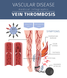 血管疾病。静脉血栓形成症状, 治疗图标设置。医疗图表设计。矢量插图