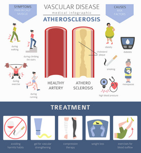 血管疾病。动脉粥样硬化症状, 治疗图标设置。医疗图表设计。矢量插图