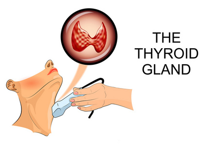 超声波诊断的甲状腺