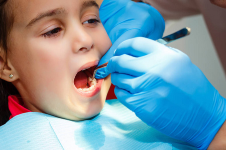 儿童牙医办公室的治疗把海豹放在一个小女孩的牙齿上