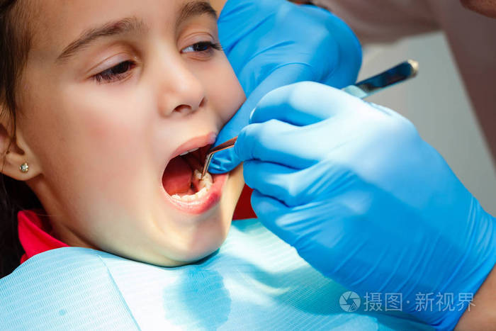 儿童牙医办公室的治疗把海豹放在一个小女孩的牙齿上