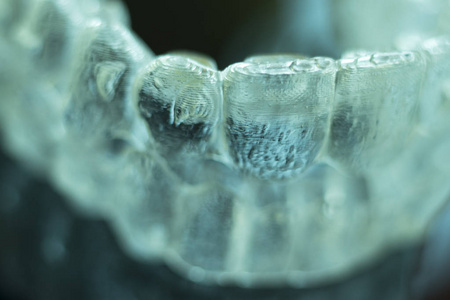 不可见牙直线对准器括号用于对齐每颗牙齿在化妆品牙科为患者