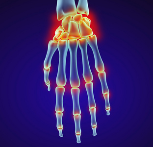 人类的腕关节解剖。X 射线视图。医学上准确的 3d 图