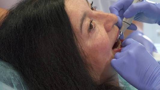 牙医提供超声波清创的女人