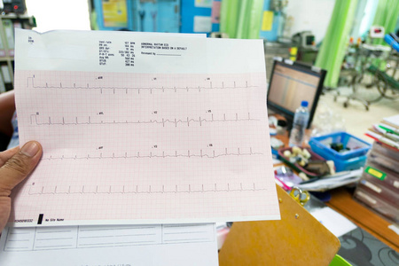 心脏分析, 心电图图 心电图 在手医生在医院