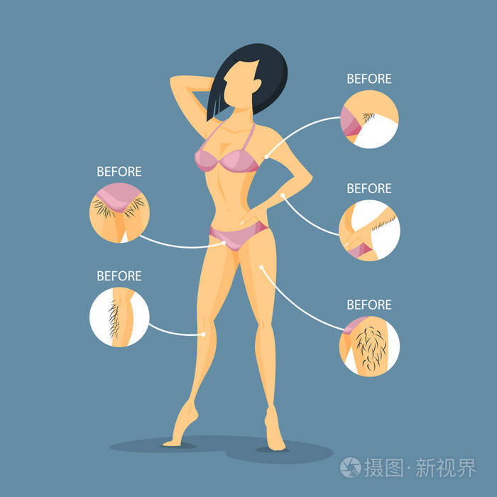 脱毛前后阿米特和比基尼区