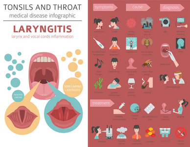 扁桃体和咽喉疾病。喉炎症状, 治疗图标集。医疗信息图设计。向量例证