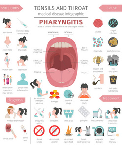 扁桃体和咽喉疾病。咽炎症状, 治疗图标集。医疗信息图设计。向量例证