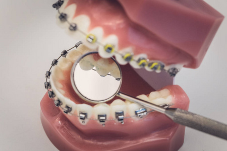 详细关闭在假牙或桌子上的牙齿上工作的牙科器械, 牙科