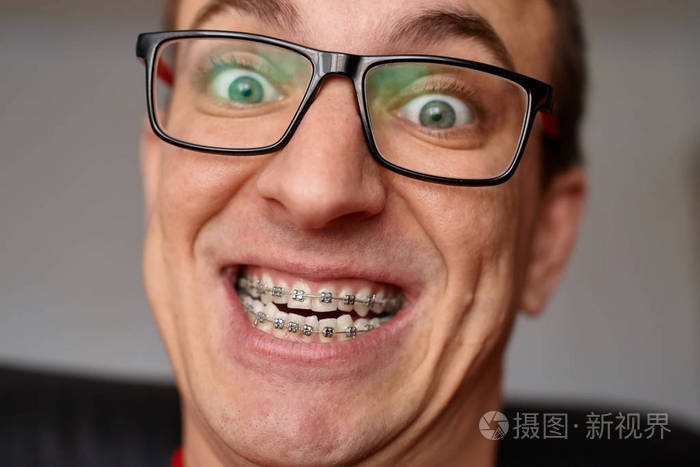 弯曲的牙齿的家伙与牙套在眼镜关闭关闭.人的肖像.疯狂的脸.